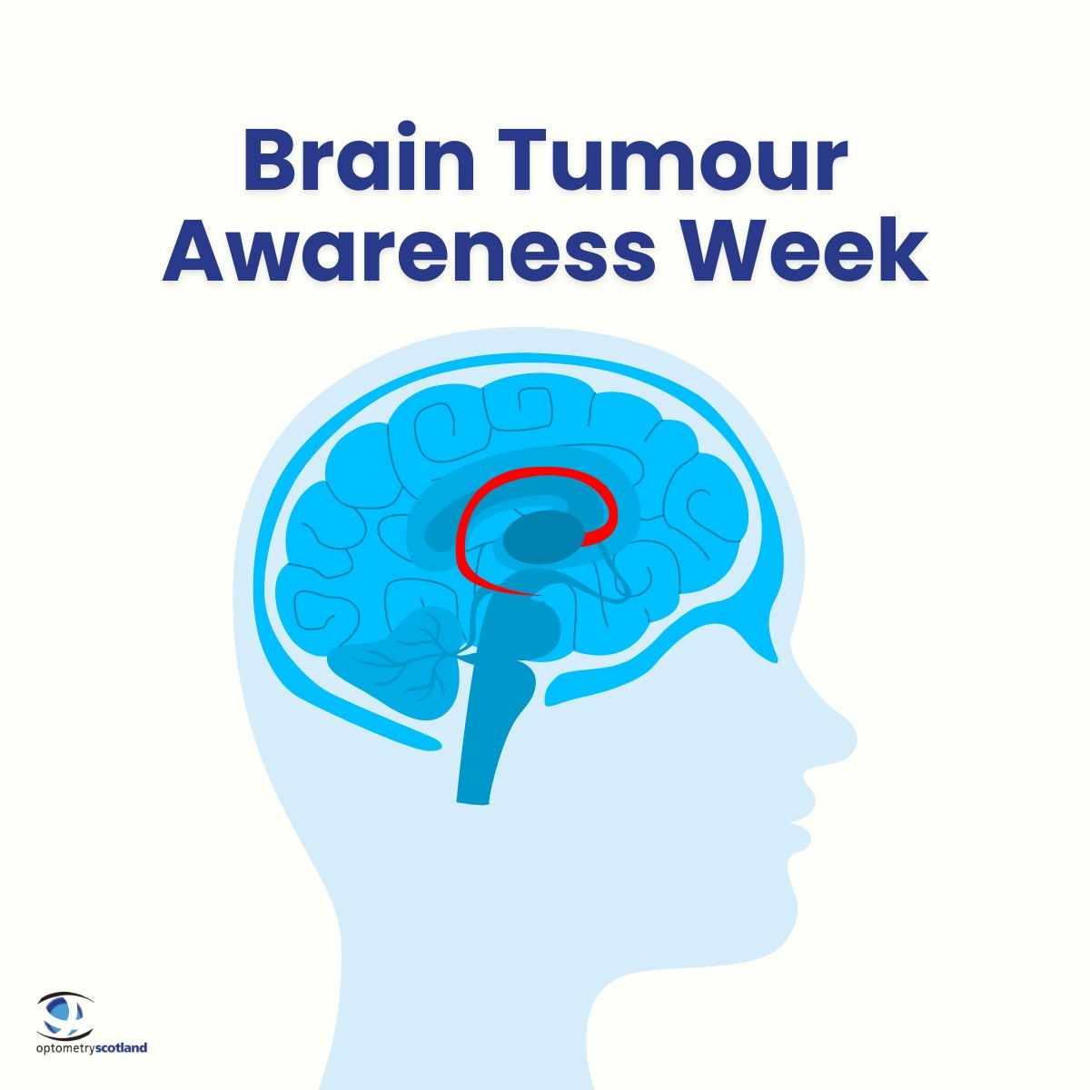 Optometry Scotland tweet media