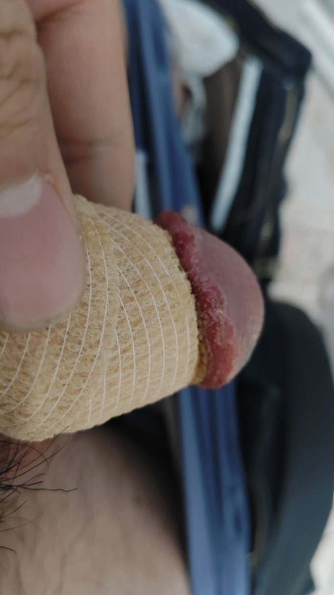 有点涩涩的人 tweet media