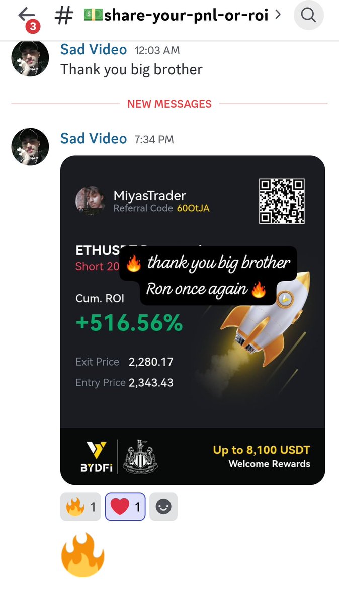 LiveTraderRon tweet media