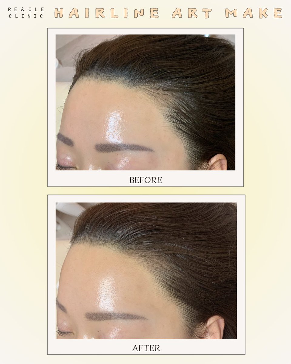 ソウル皮膚科🩵リー・アンド・クル tweet media