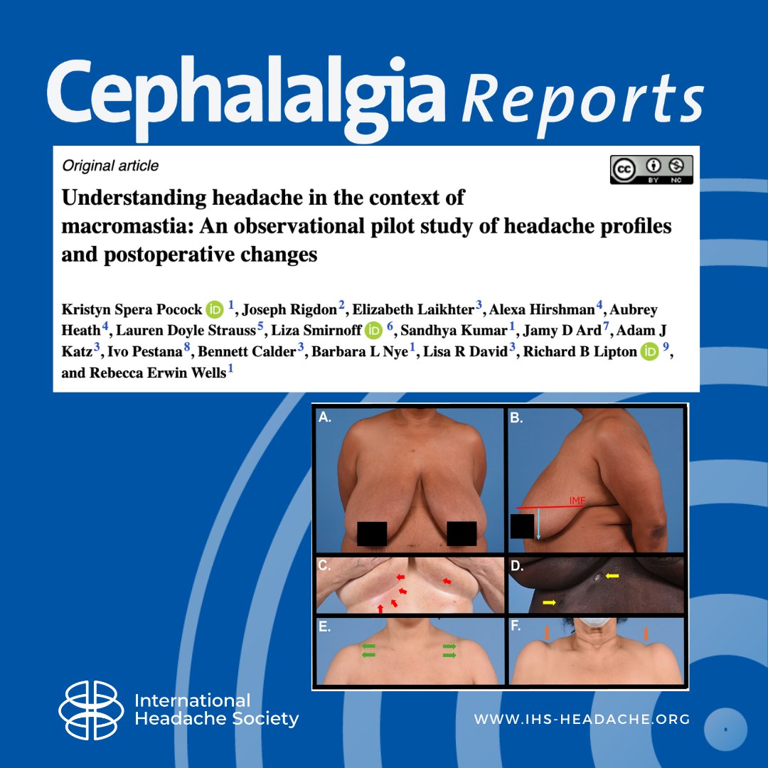 Cephalalgia tweet media
