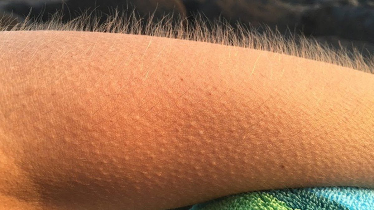 MadeInSporting tweet media