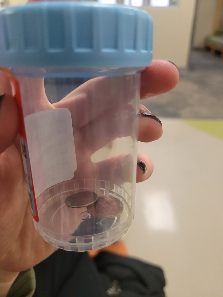 rhutchpierce's tweet photo. She gets prepped for the procedure. Goes in, and it doesn't take more than 20 minutes to get the call she's done.

THAT LITTLE SHIT DID, IN FACT, EAT A DIME AND A PENNY. They were just stuck together in her little tummy. 

So we've met our insurance deductible for $0.11... https://t.co/tzmArJvp3r