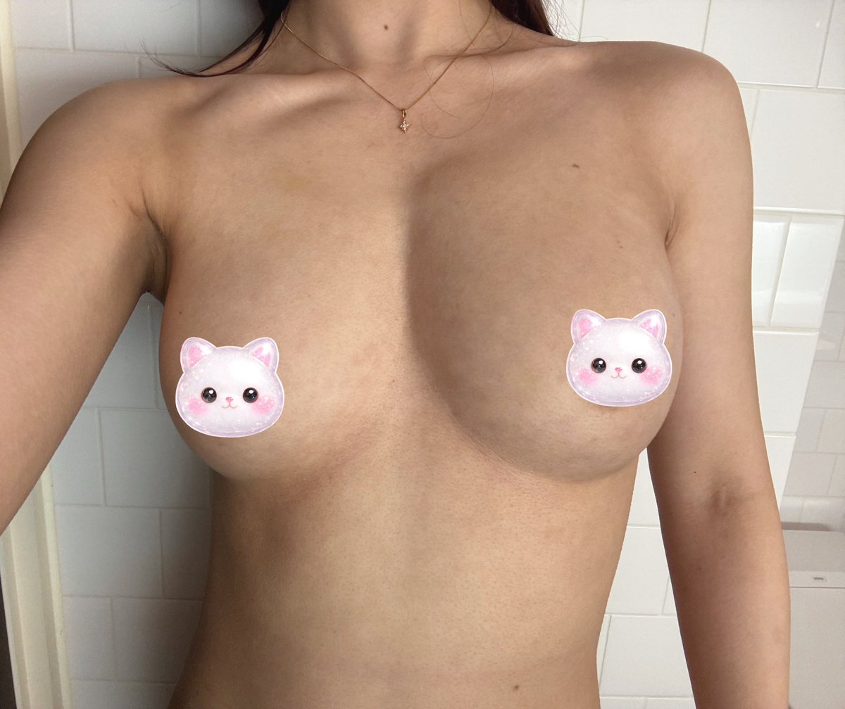 脂肪豊胸2次DT中 tweet media