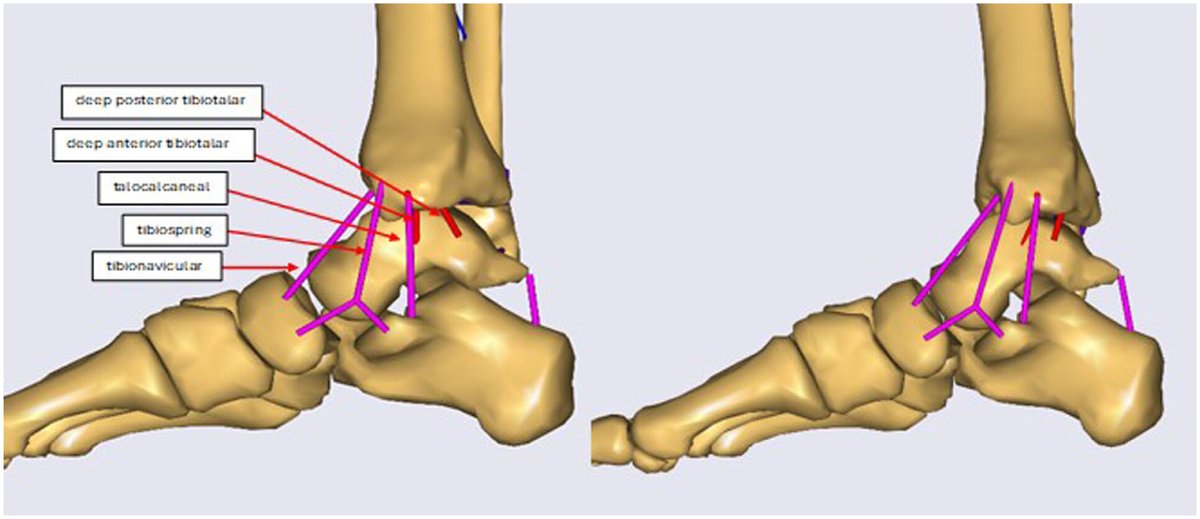 AnyBodyTechnology tweet media