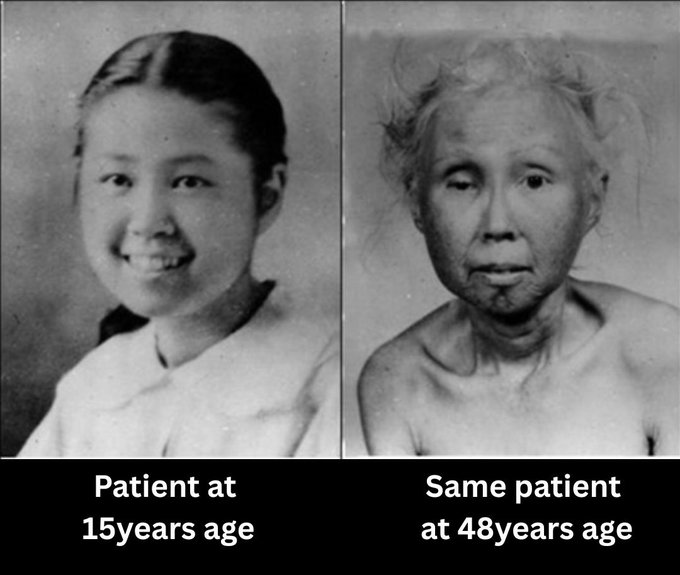 Dr. Akhil 🇮🇳 tweet media