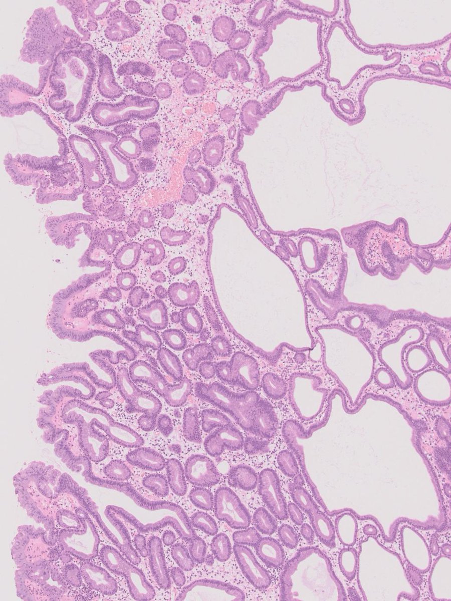 Charlie Herndon tweet media