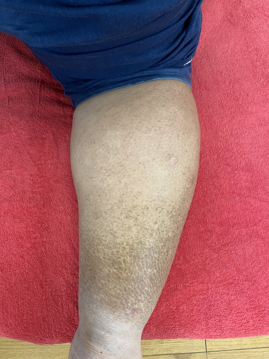 シゲ @MINI乗り鍼灸マッサージ師 tweet media