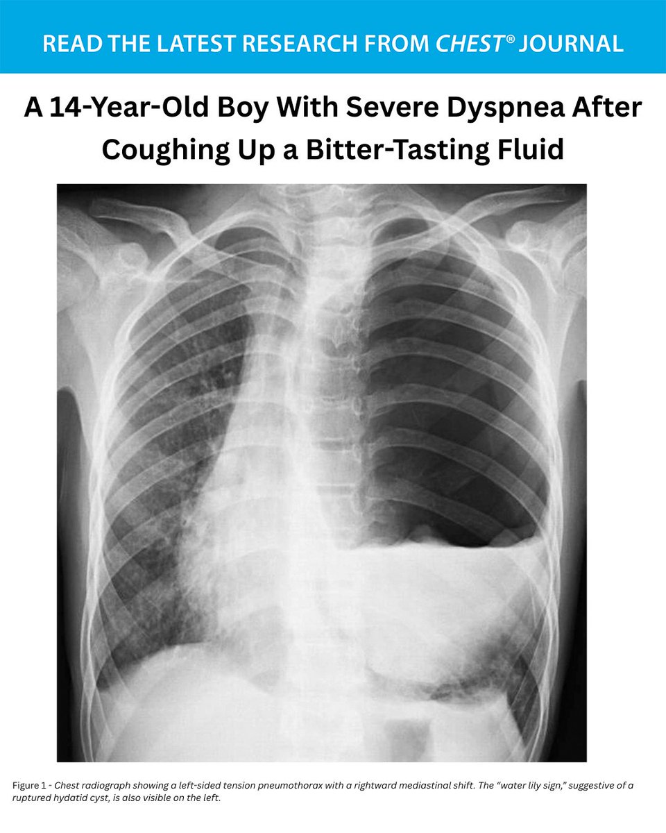 CHEST® Journal tweet media