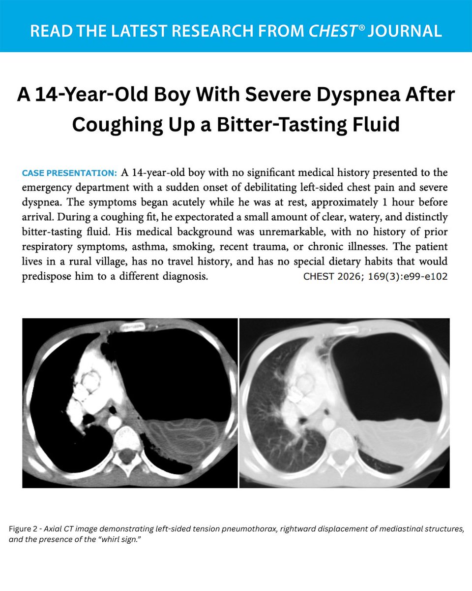 CHEST® Journal tweet media