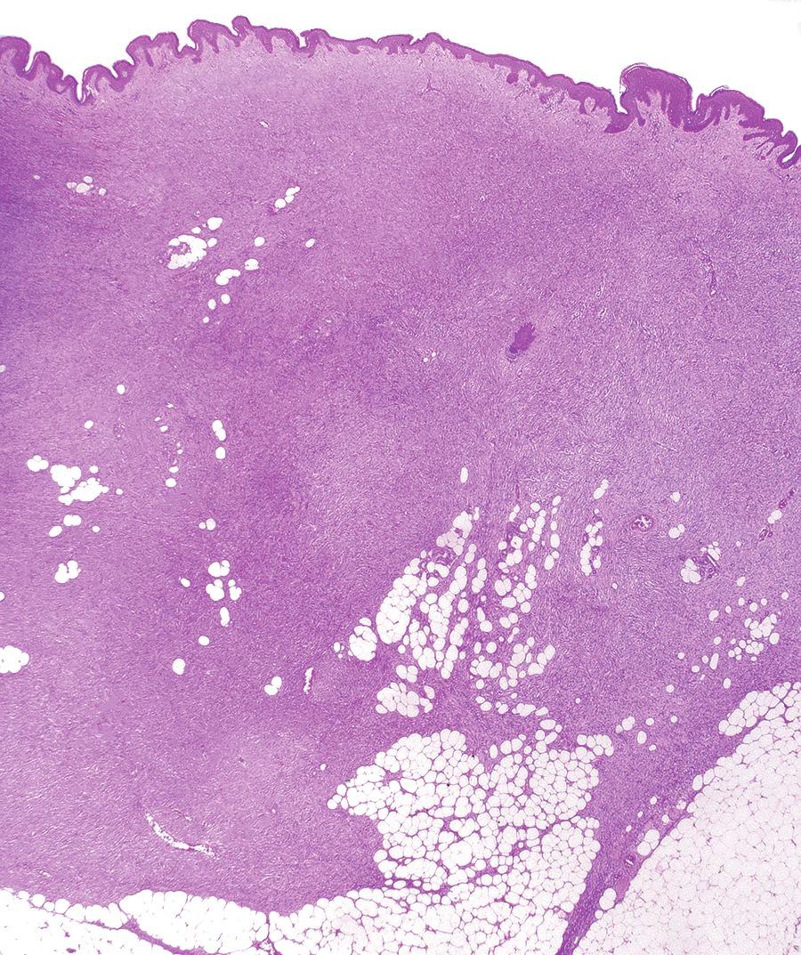 Charlie Herndon tweet media