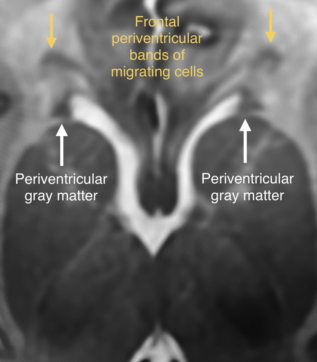 Jordi Roldan tweet media