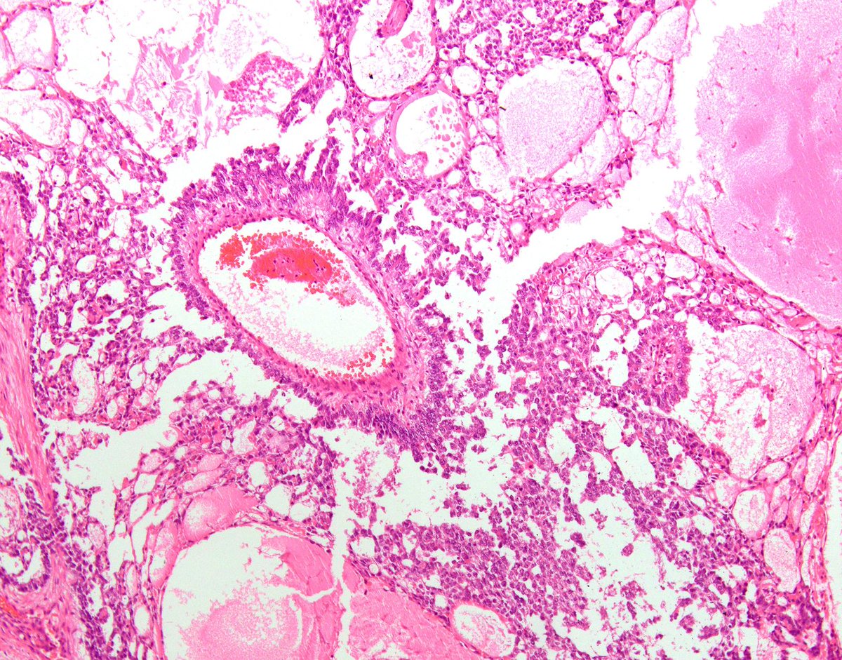 Charlie Herndon tweet media