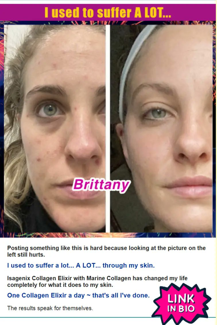 Anthony Lombardo tweet media