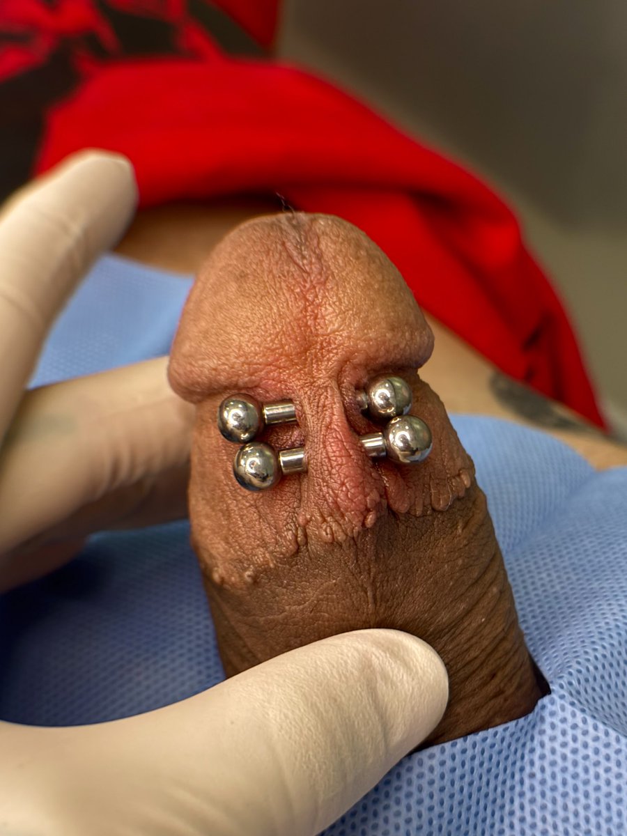 #frenumpiercing 3mm recem feito ✨