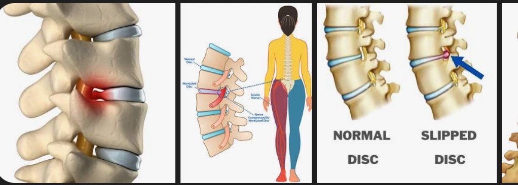 𝗫𝗙𝗮𝗰𝘁𝗼𝗿:-) tweet media