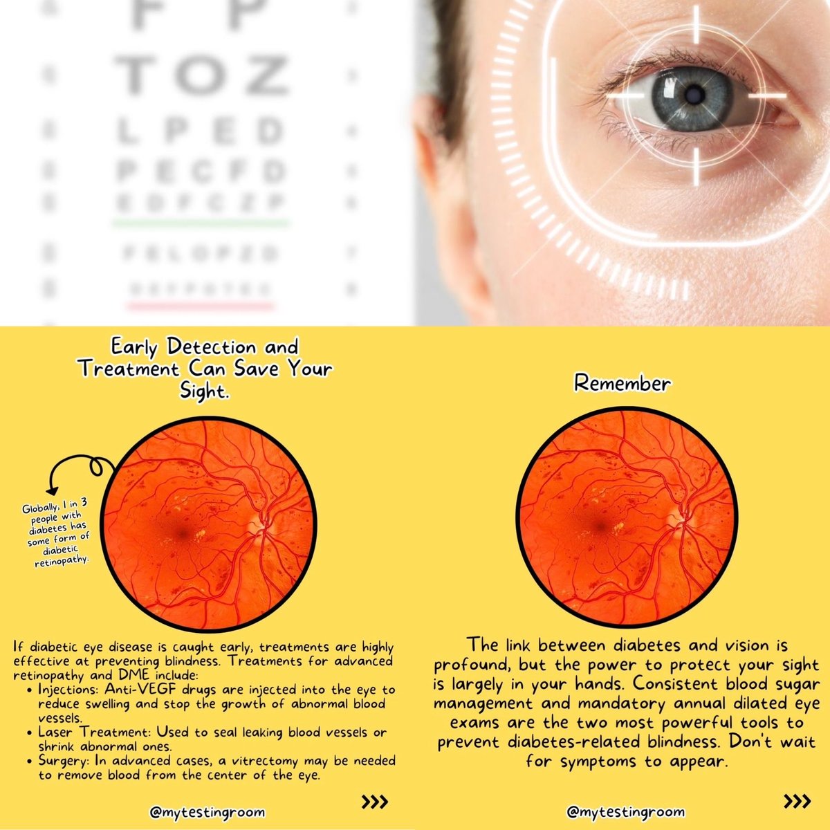 Diabetes is a disease that can significantly affect your eyes 👀 resharing a great post from @mytestingroom about the important reminder of full comprehensive eye exams 👓 

Those with diabetes are twice as likely to develop glaucoma compared to those without diabetes? 🚨