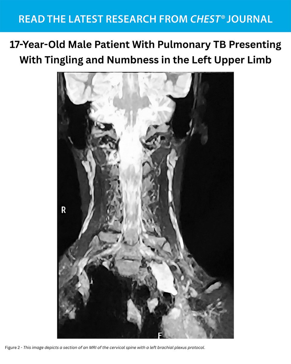 CHEST® Journal tweet media