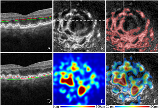 IOVS Journal tweet media