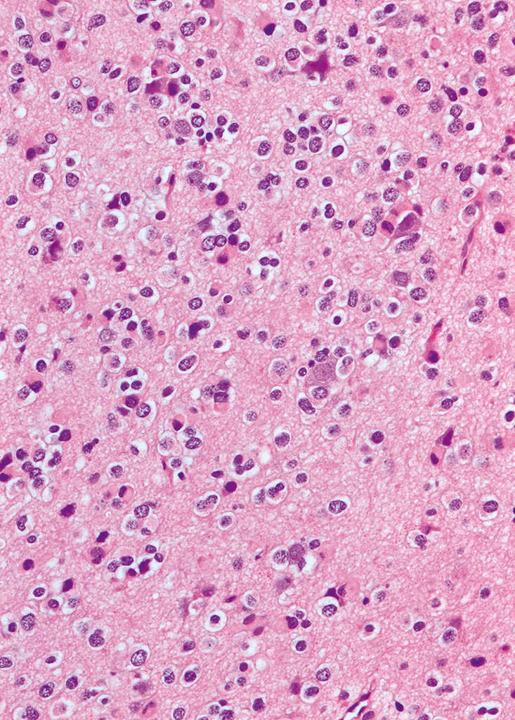 Charlie Herndon tweet media