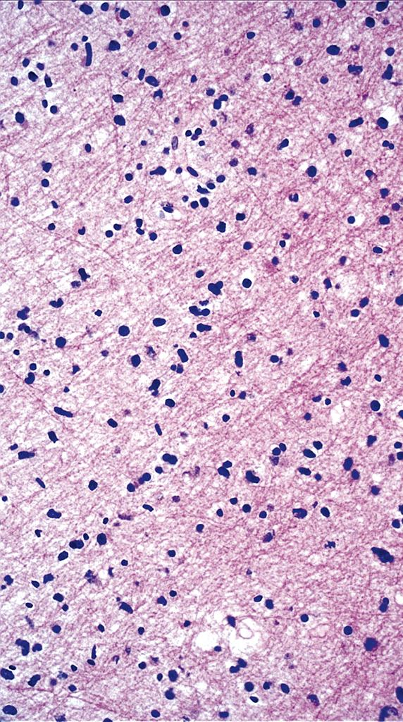 Charlie Herndon tweet media