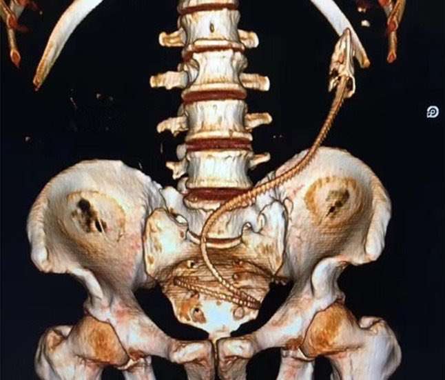 Keith Siau tweet media