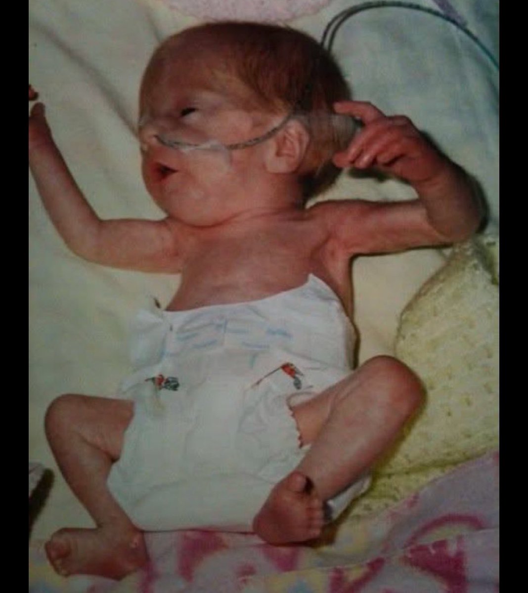 Anna Lulis tweet media