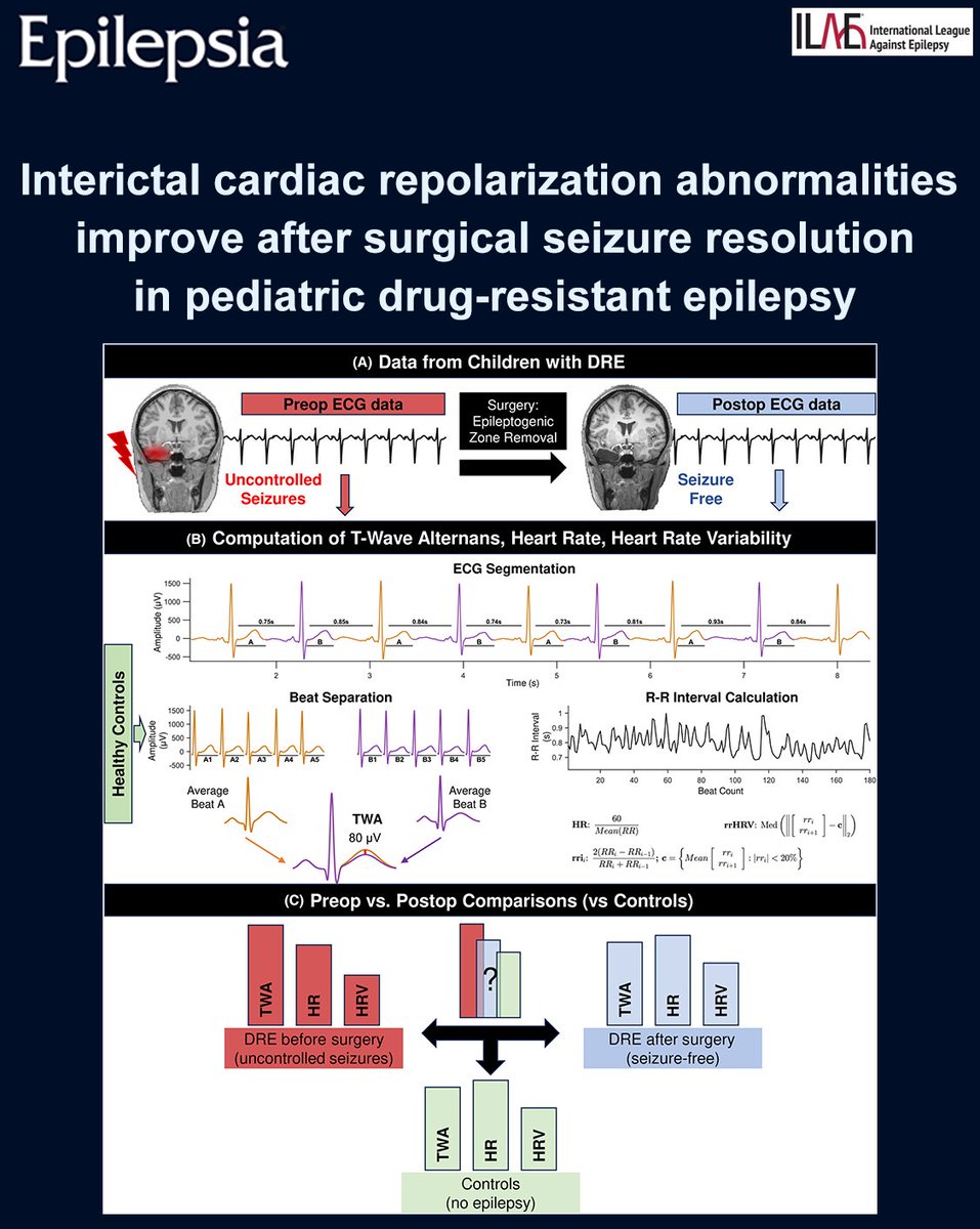 EpilepsiaJourn's tweet photo. Successful epilepsy surgery reduces cardiac electrical instability in children, supporting T-wave alternans as a marker of recovery.
https://t.co/sHKAjE9Z83
#epilepsy #ILAE #epilepsiajourn #cardiacelectricalinstability #ECG #heartratevariability #pediatric #Twavealternans https://t.co/oQ3IJsavNK