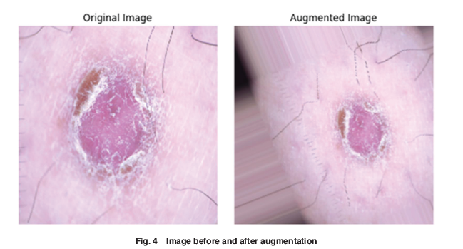 ASMEJournals's tweet photo. A medical scanning device for early detection of skin cancer. https://t.co/BrqtK41NL5
#medicaldevice #deeplearning #skincancer https://t.co/ld6IXe8RXG