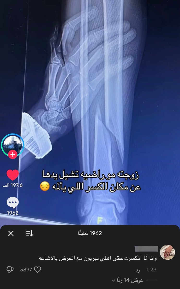 الـدُوســري tweet media