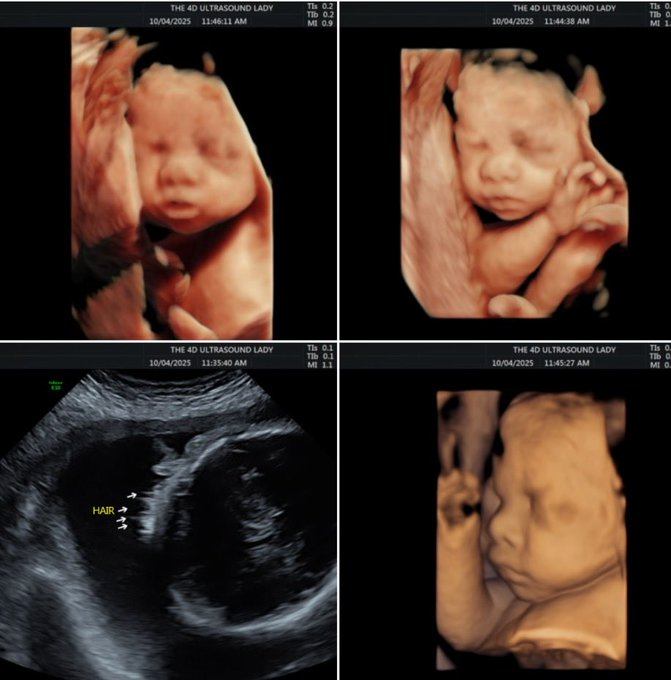 𝕊𝕠𝕝𝕒 ℂ𝕙𝕒𝕕 🎚️ tweet media