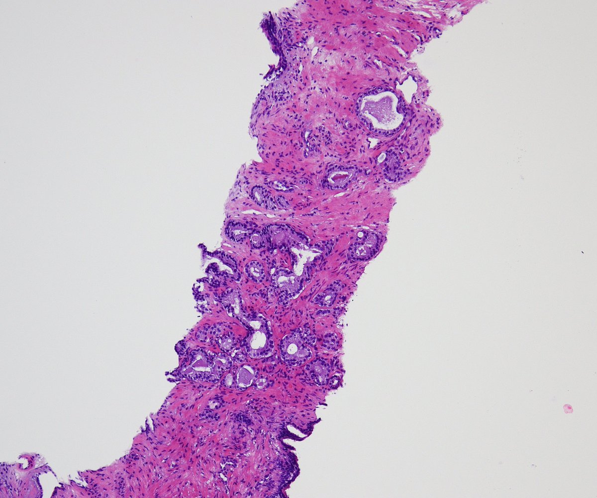 Miruna Popescu, MD tweet media