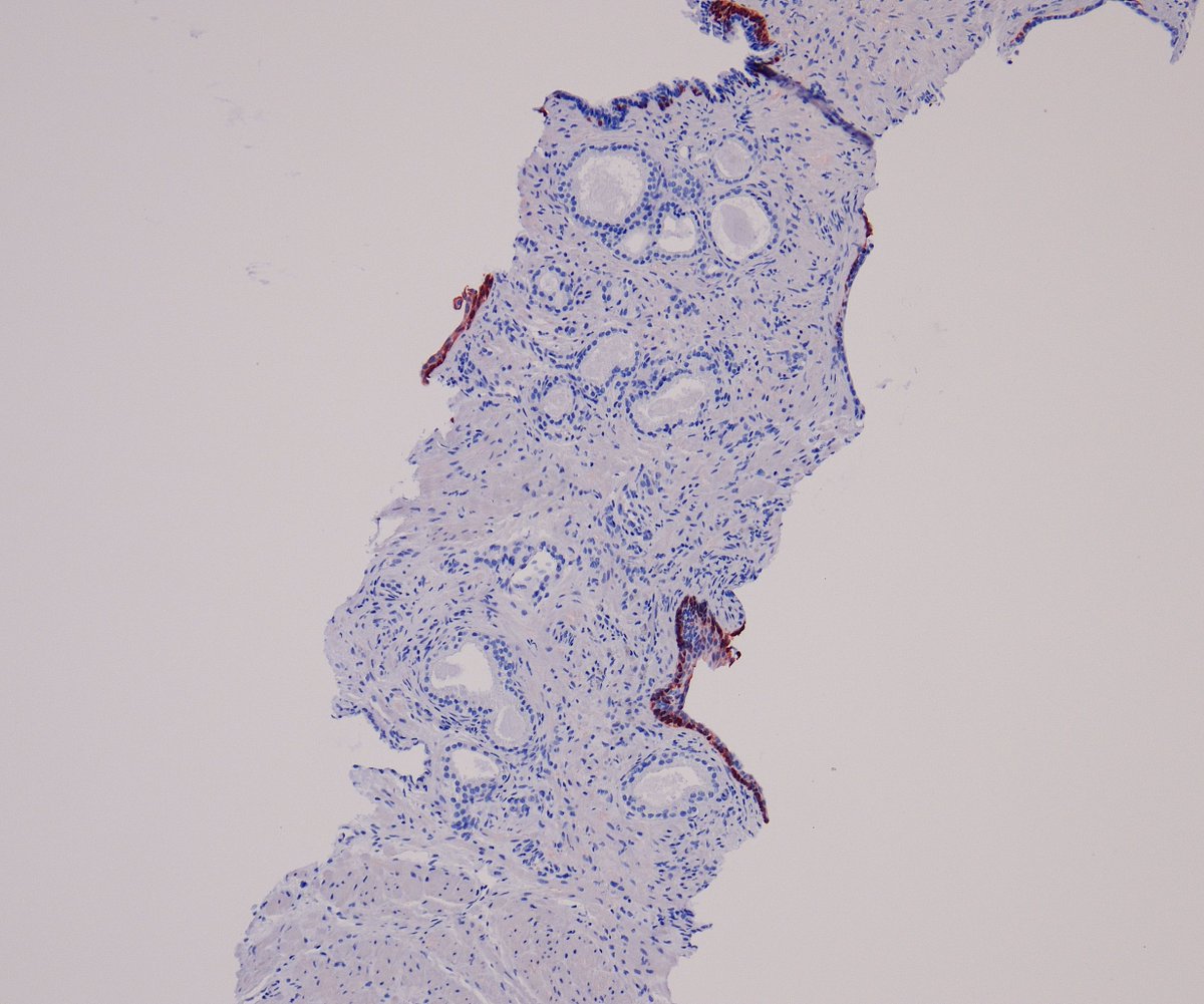 Miruna Popescu, MD tweet media