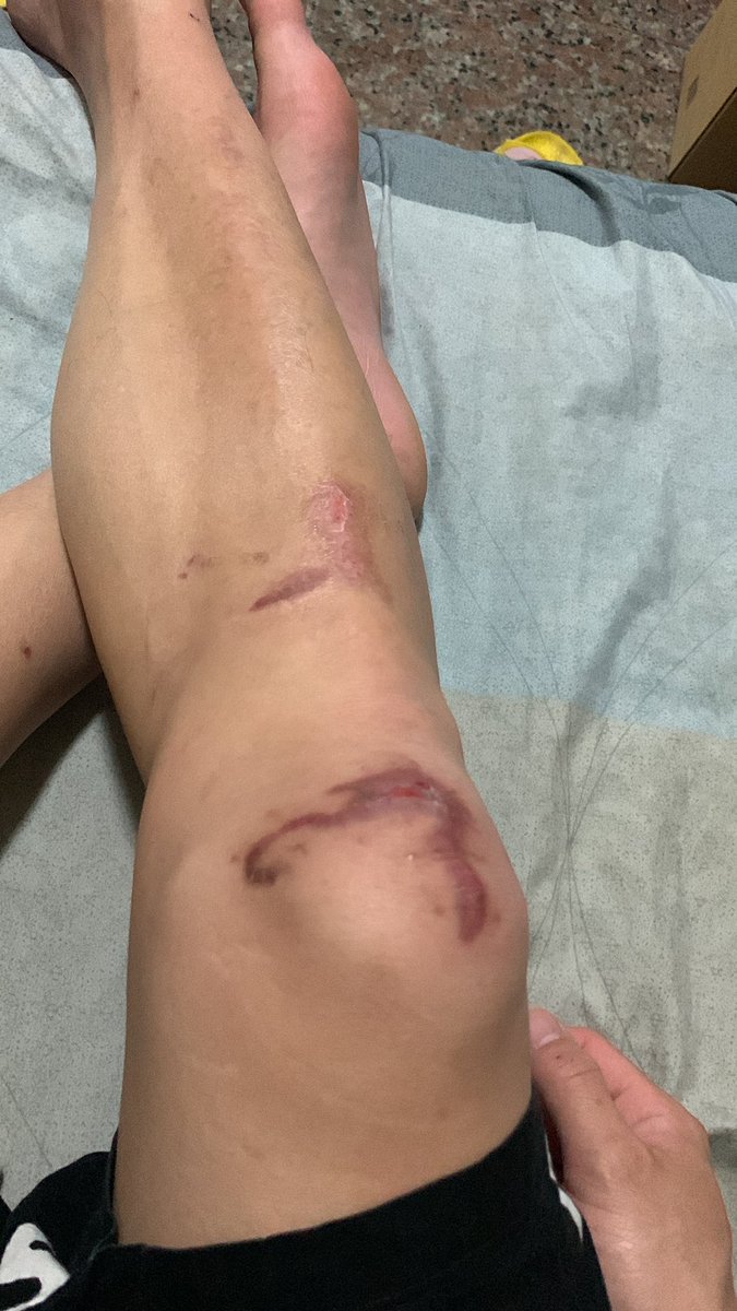 山林老良 tweet media