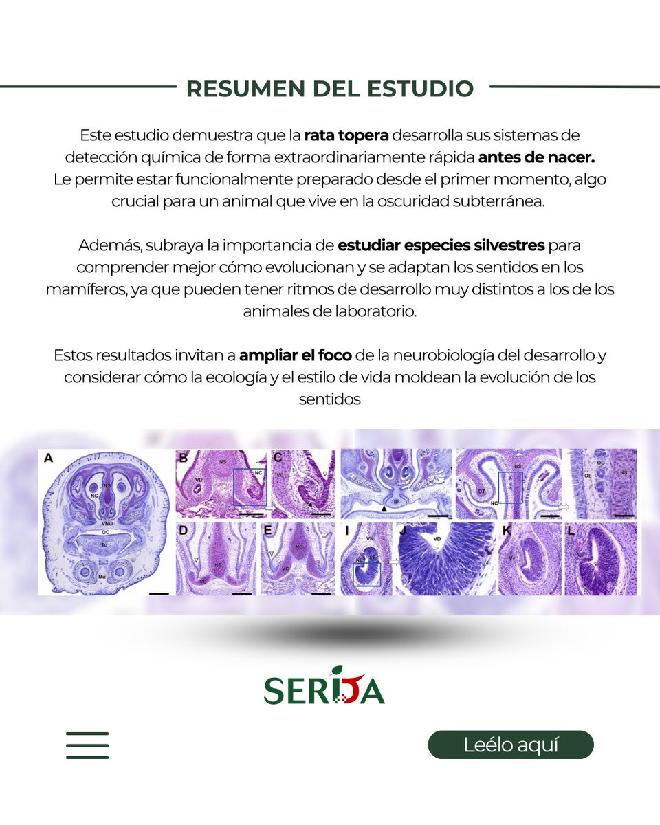 SeridaAst's tweet photo. ¡Nuevo artículo científico! 📋

El investigador Aitor Somoano ha participado en un estudio sobre el desarrollo prenatal de los sistemas olfatorios de la rata topera. ✅

https://t.co/GTFZf5YCaS https://t.co/hO4OINvxCg