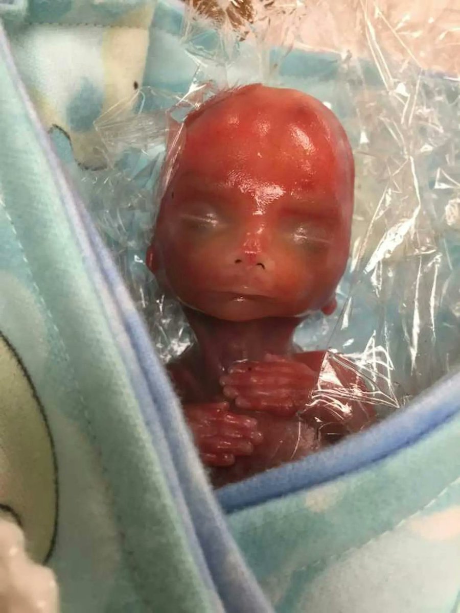 Live Action tweet media