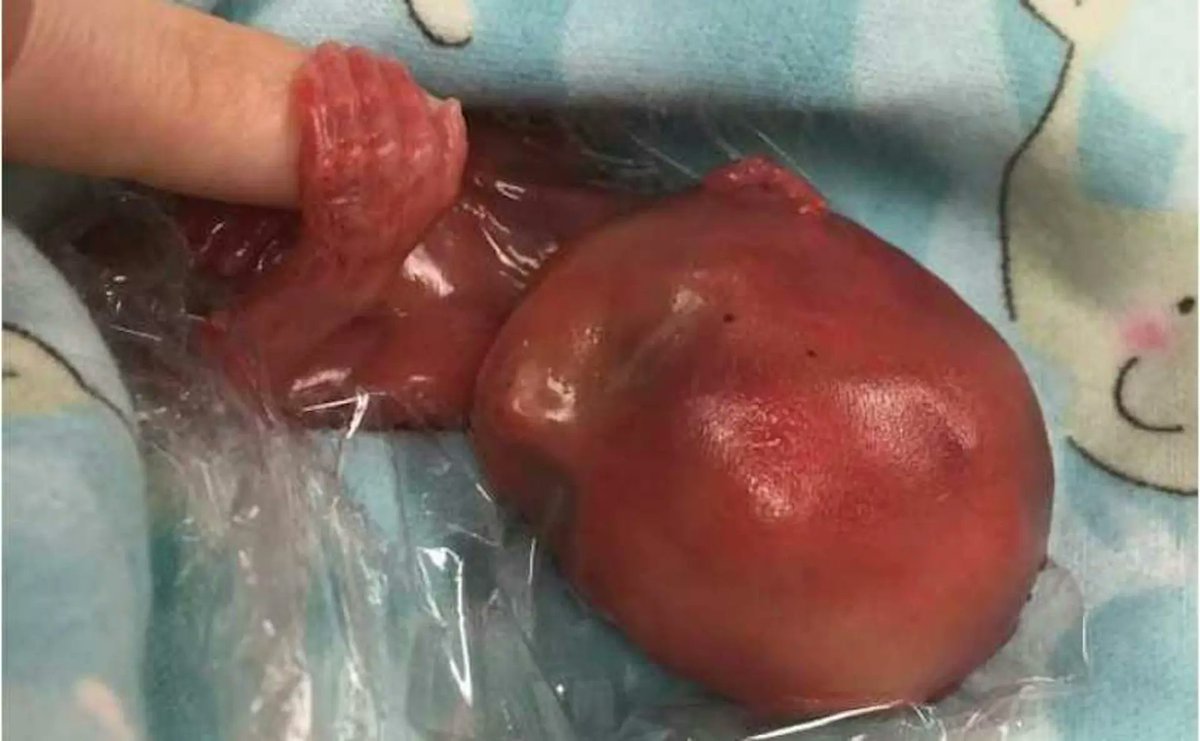 Live Action tweet media