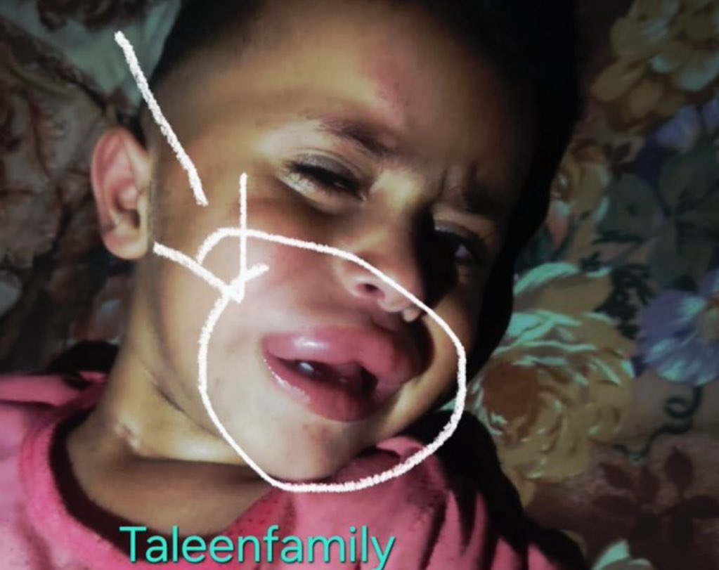 Taleen Family 🍉 tweet media