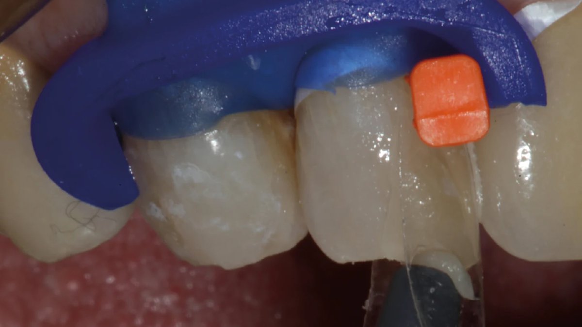 insidedentistry tweet media