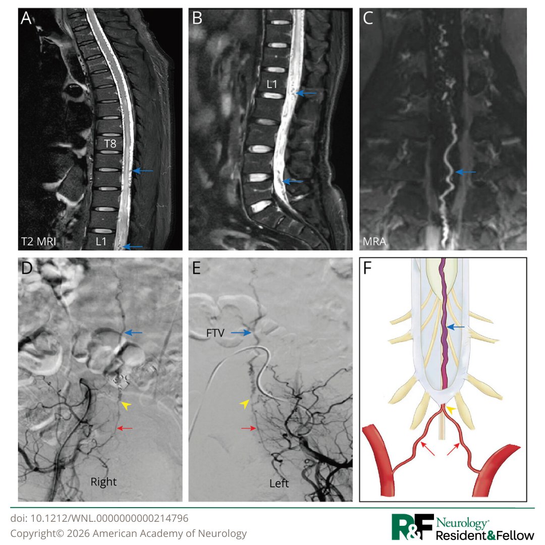 Neurology Journal tweet media