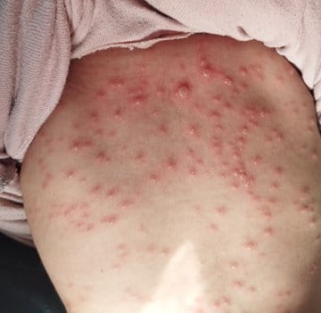 Rana Noreen 🇵🇸🍉 tweet media