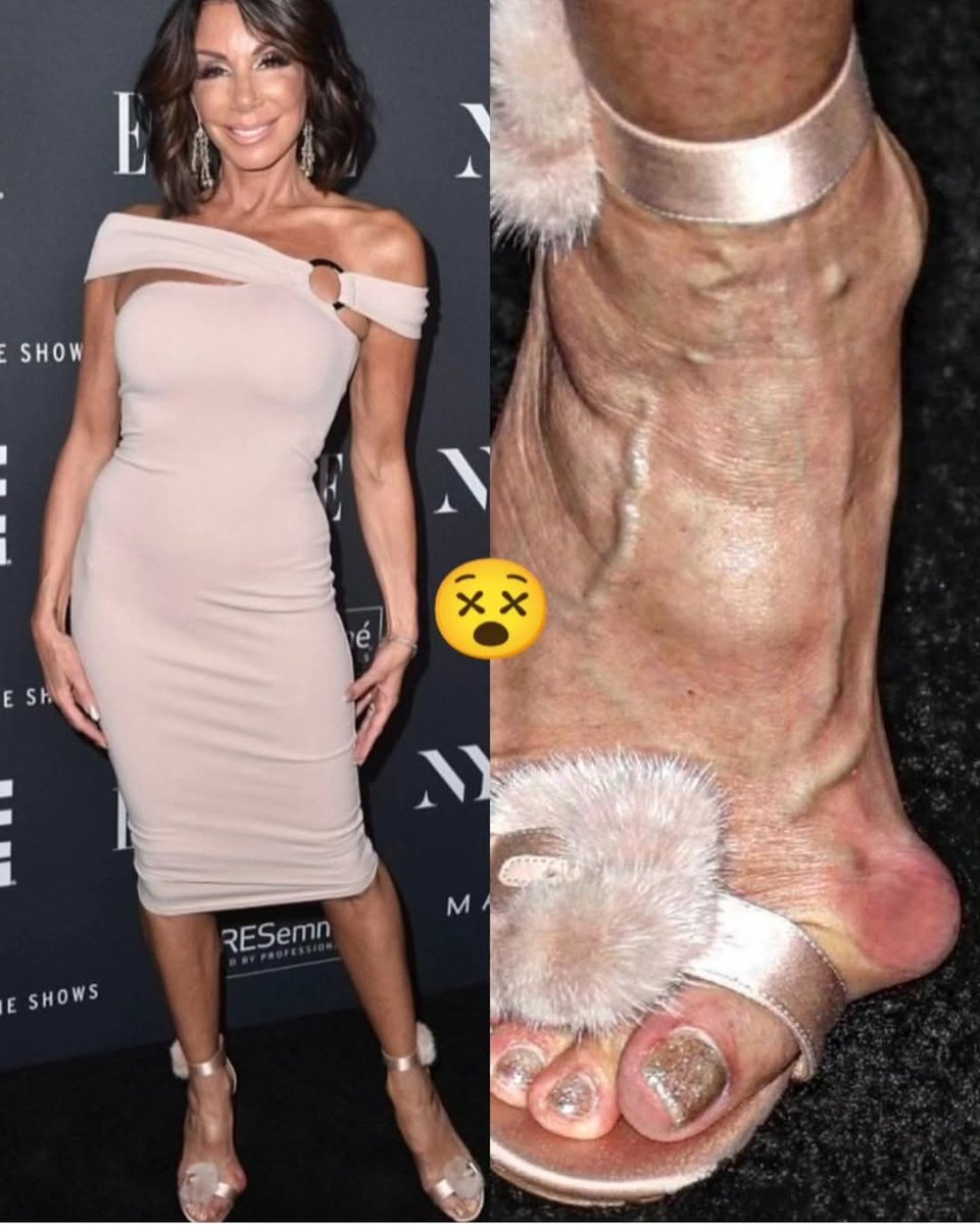 CharlieBasuko tweet media