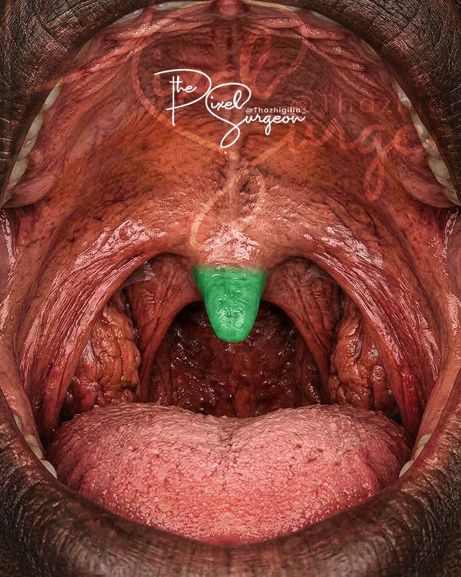 Simon Thazhigilla Simon🇳🇬 tweet media