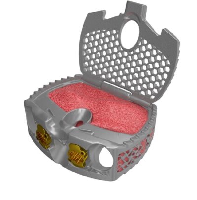 Spinal Elements Expands Ventana® Platform with FDA 510(k) Clearance and First Cases of Ventana® A ALIF System
thespinemarketgroup.com/spinal-element…
