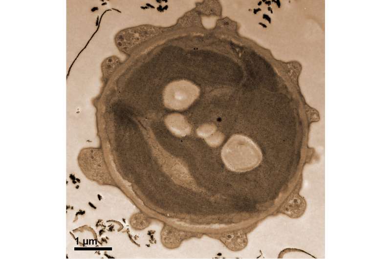StainsFile tweet media