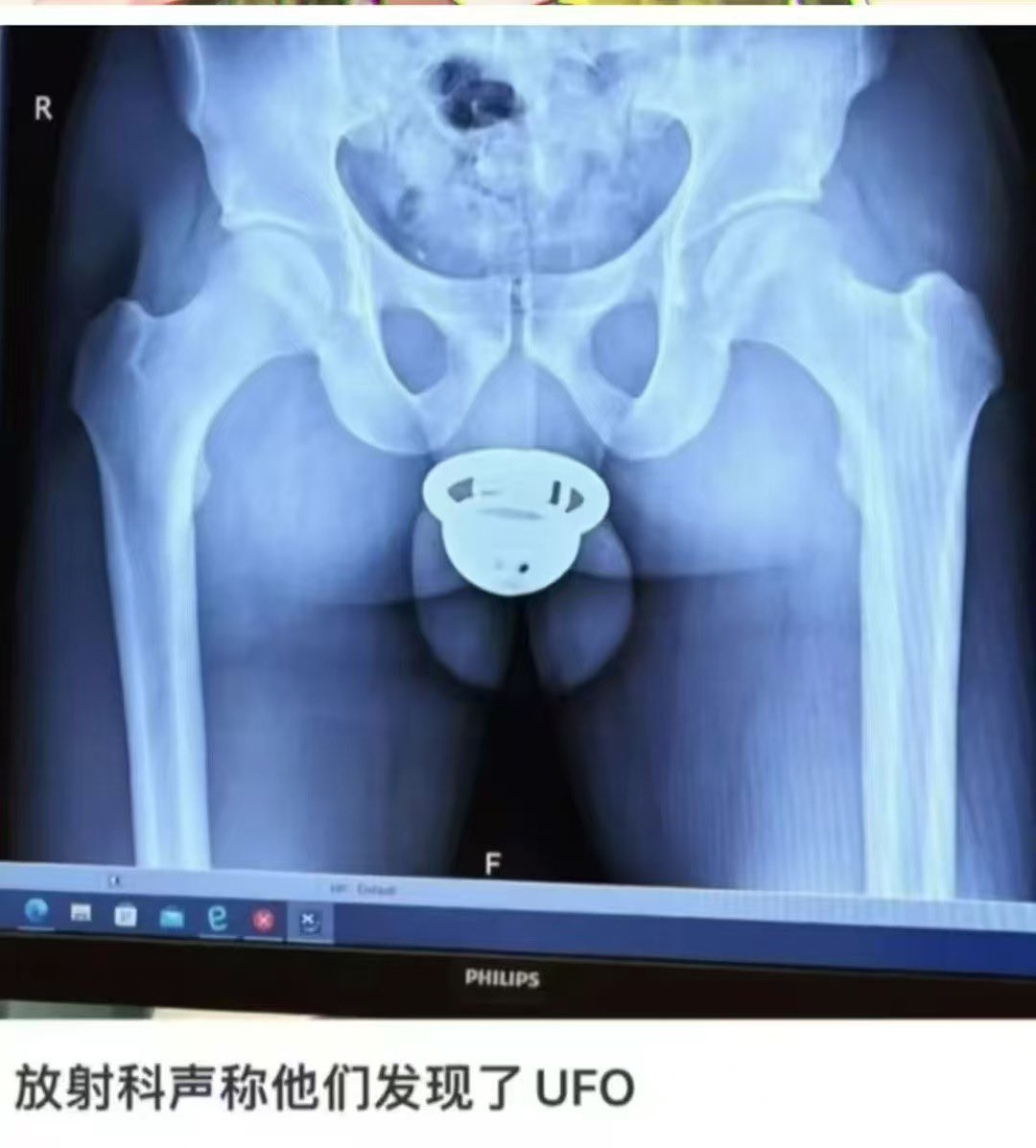 太阳瓜 tweet media