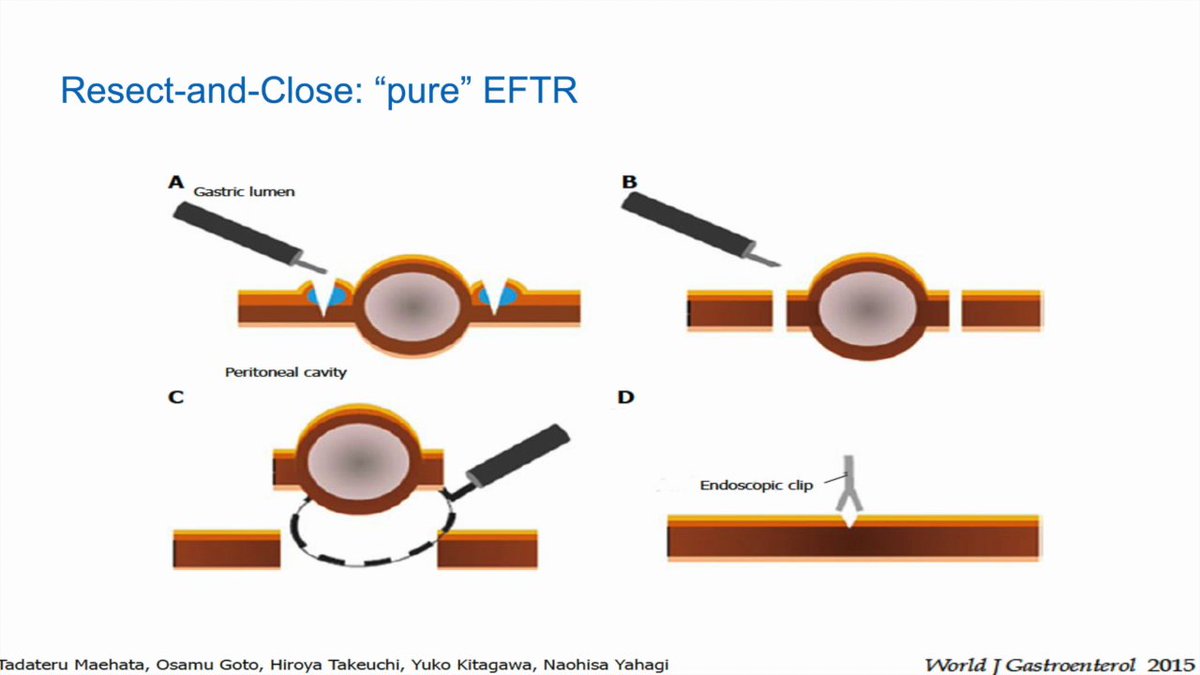 EndoCollab™ | GI Endoscopy Community tweet media