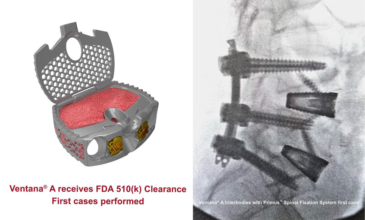 Spinal Elements tweet media