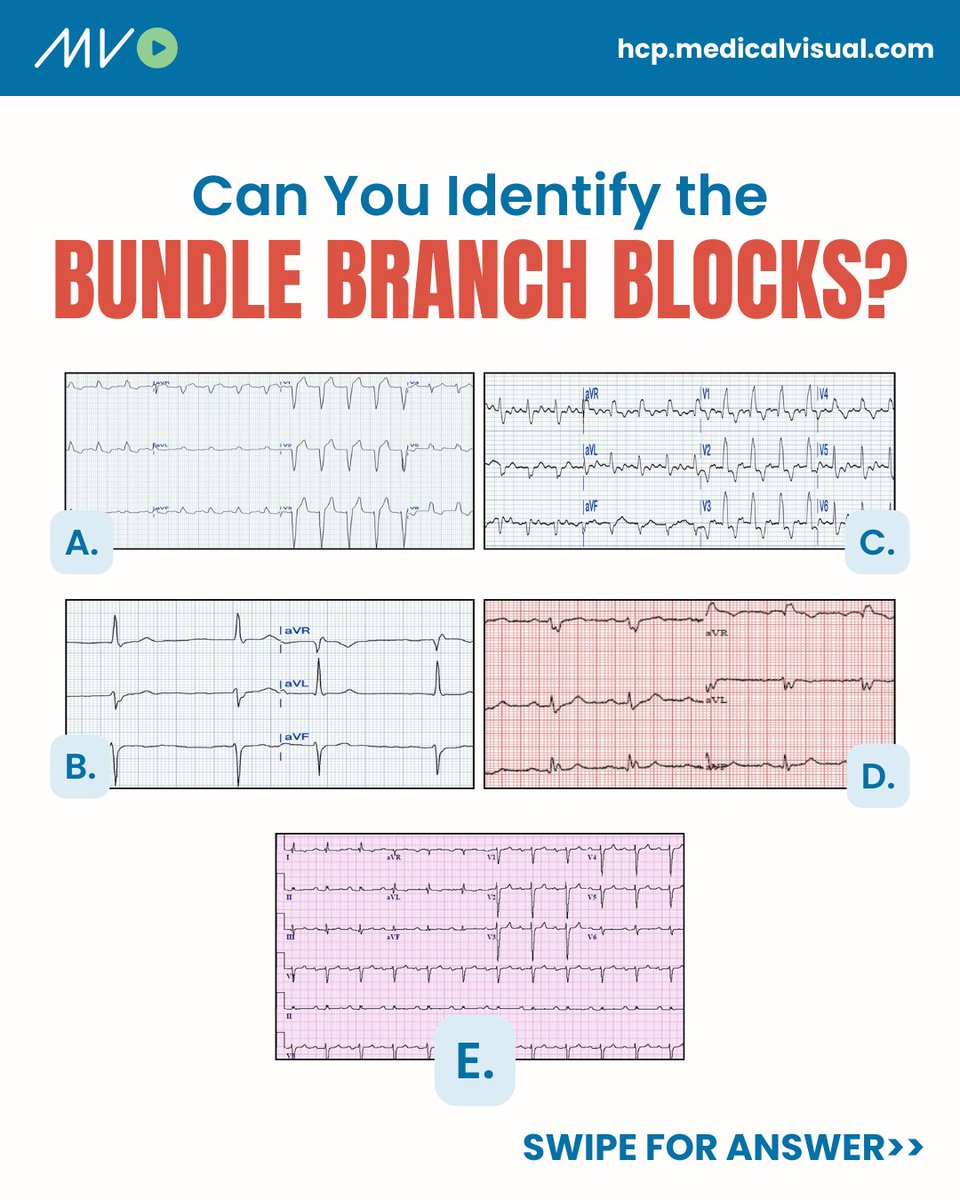 CardioVisual: Powered by MedicalVisual tweet media