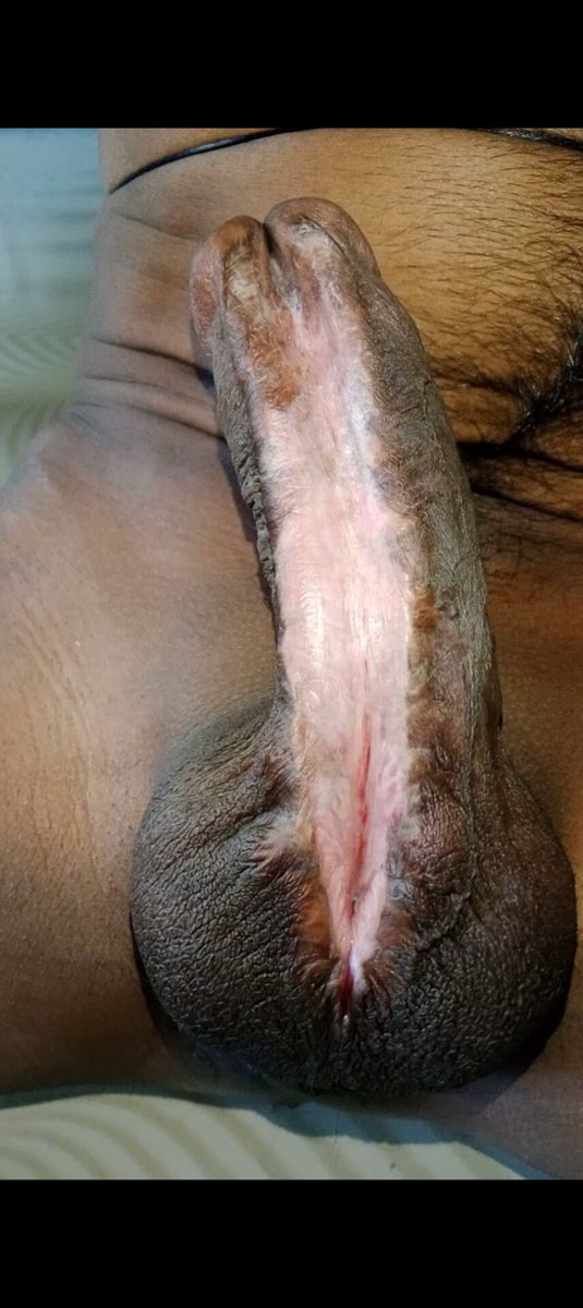 @monster subincision tweet media